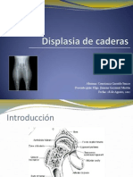 Displasia de Caderas