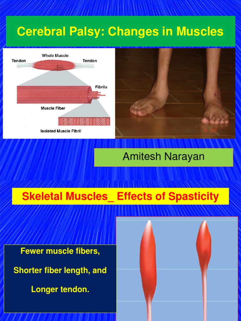 Muscles Changes in Cerebral Palsy | PDF