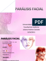 Presetación Parálisis Facial
