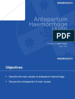 Antepartum Haemorrhage (APH) : Prepared by Helen Cooke