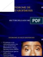 Sindrome de Blefarofimosis