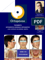 CASO TOCO - Tratamento Ortodôntico-Cirúrgico-Ortognático