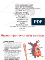 Cirugias Cardiacas