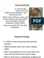 Anencephaly