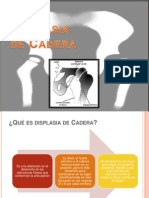 Displasia de cadera: causas, signos y tratamiento