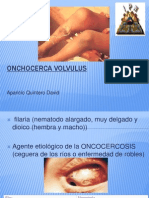Onchocerca Volvulus