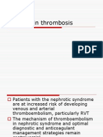 Renal Vein Thrombosis