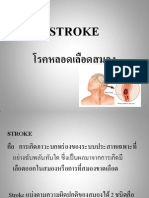 Stroke