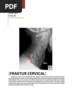 Download LAPORAN PENDAHULUAN FRAKTUR CERVICAL by khikmatul mujizah SN121567191 doc pdf