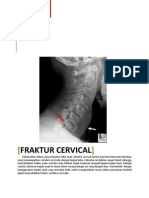 Laporan Pendahuluan Fraktur Cervical