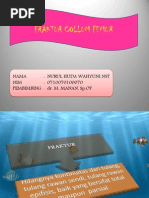Download fraktur collum femur by Nurul Huda Wahyuni Nasution SN121804301 doc pdf