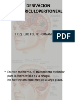 Derivacion Ventriculoperitoneal