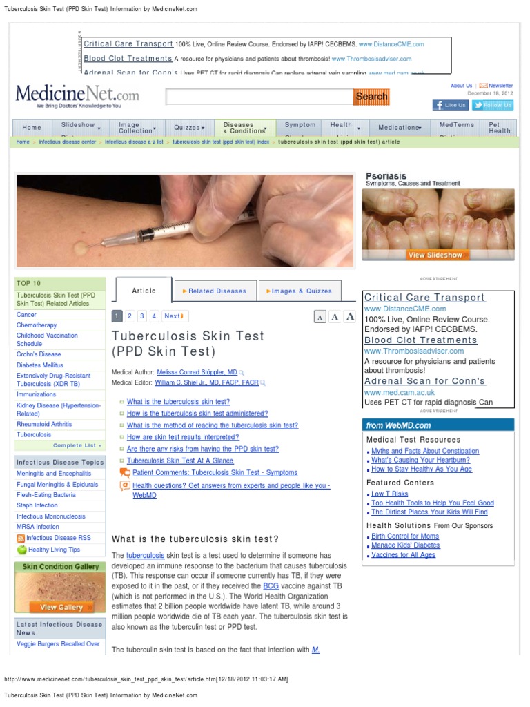 Prueba de PPD | PDF | Crohn's Disease | Tuberculosis