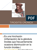 Tiroiditis Cronica