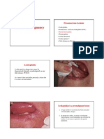 Leukoplakia