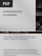 Condensacion Pulmonar