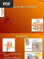 135122988 Hernia De Disc