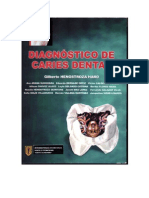 Henostroza Gilberto - Diagnostico de Caries Dental