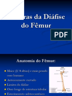 Fraturas Da Diafise de Femur