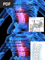 ESCOLIOSE