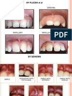 FRENECTOMY