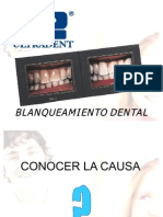 52416947 Blanqueamiento Dental