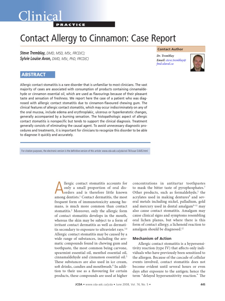 Clinical Contact Allergy To Cinnamon Case Report PDF Immune