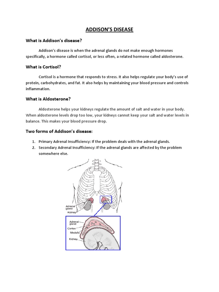 What Is Addison's Disease? | PDF | Wellness | Lifestyle