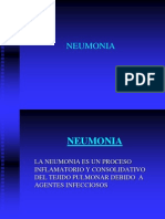 Neumonia