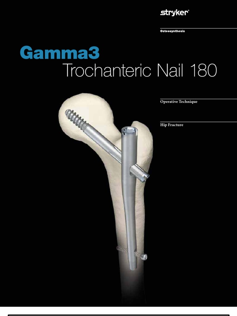 Gamma Nail | PDF | Screw | Surgery