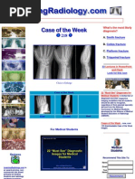 Hand Bone Age Atlas - Greulich-Pyle OXFORD Remake | PDF | Radiology ...