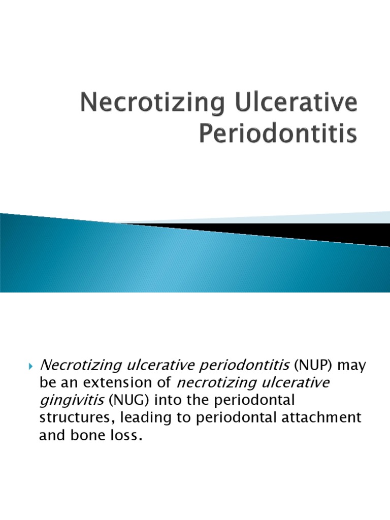 Necrotizing Ulcerative Periodontitis Overview | PDF | Dentistry ...