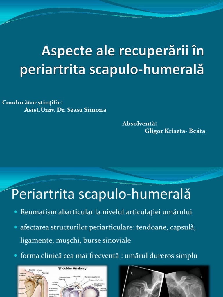 periartrita scapulohumerala ppt edemă la genunchi și durere; restricție de mișcare