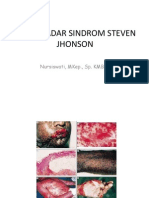 Sindrom Steven Jhonson