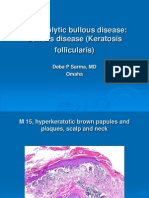 Bullous Disease of The Skin, Acantholytic Bullous Disease (Darier's Disease, Keratosis Follicularis), M 15, Scalp, Neck