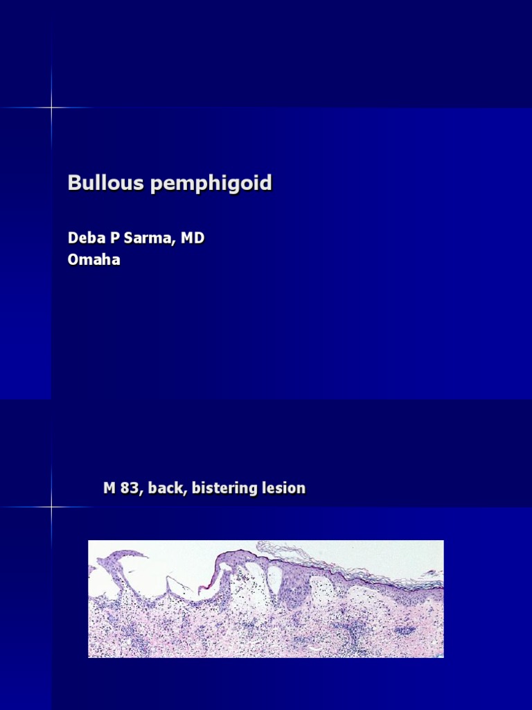 Pathogenesis of Bullous Pemphigoid | PDF