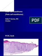 Clear Cell Acanthoma (Pale Cell Acanthoma) - M 65, Back. PPT, Rev Oct 2010