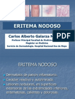 Eritema nodoso: causas, síntomas y tratamiento