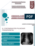 Abceso Pulmonar