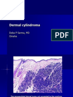 Dermal Cylindroma: Deba P Sarma, MD Omaha