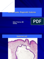 Dermal Cysts, Diagnostic Features