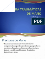 Fracturas de Mano