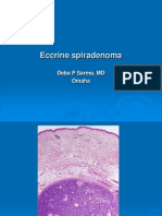 Eccrine Spiradenoma
