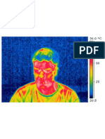 Rapport Camera Infrarouge , la thermographie 