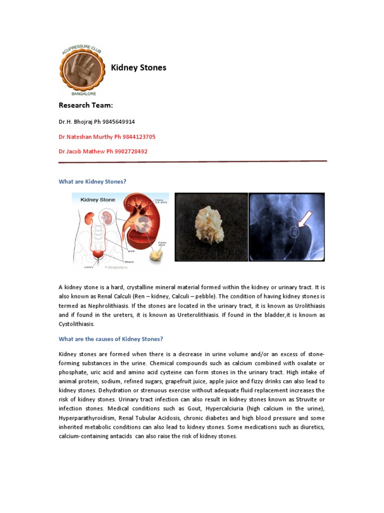 Kidney Stones | PDF | Urology | Medical Specialties