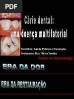 Cárie dentária