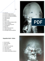 Anatomia Radiologica Do AP Locomotor