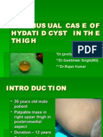 Unusual Case of Inter Muscular Hydatid Cyst