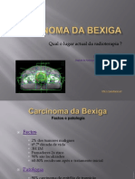 Carcinoma da bexiga