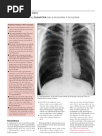 ABCDE Approach to Chest X-Ray Interpretation | PDF | Lung | Thorax